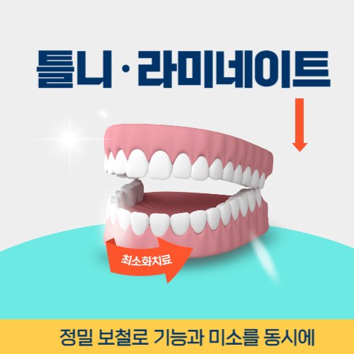 용인치과 용인시 치과 틀니 라미네이트