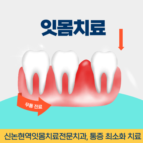 용인치과 용인시 치과 잇몸치료